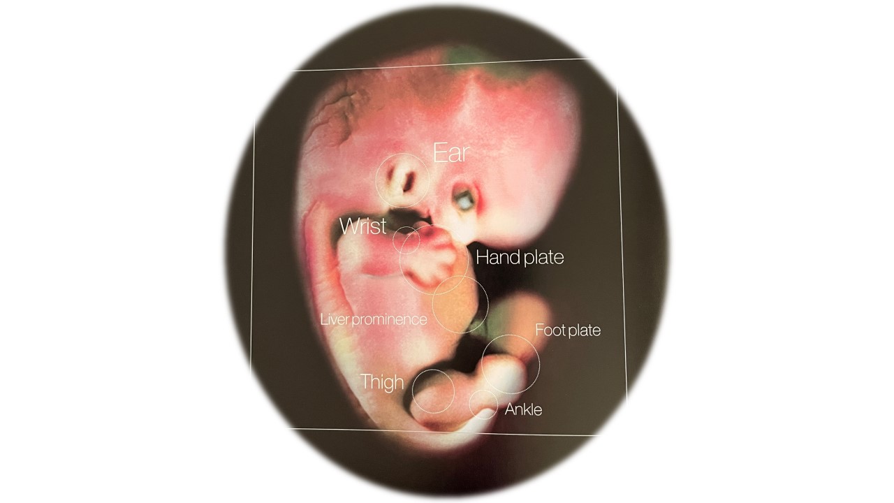 Fetal Development